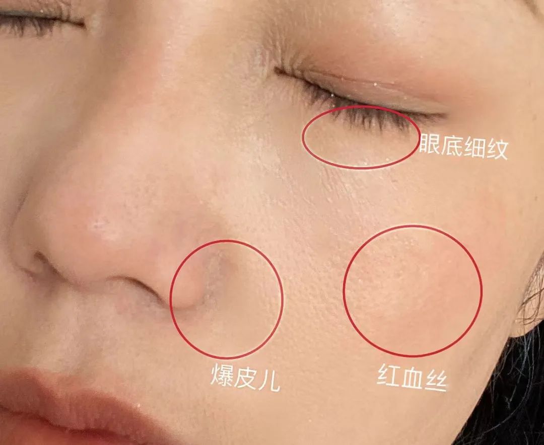 如何判斷自己是不是干敏肌膚？干敏肌有哪些特征？