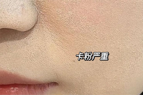 卡粉是什么意思？卡粉是什么原因引起的？